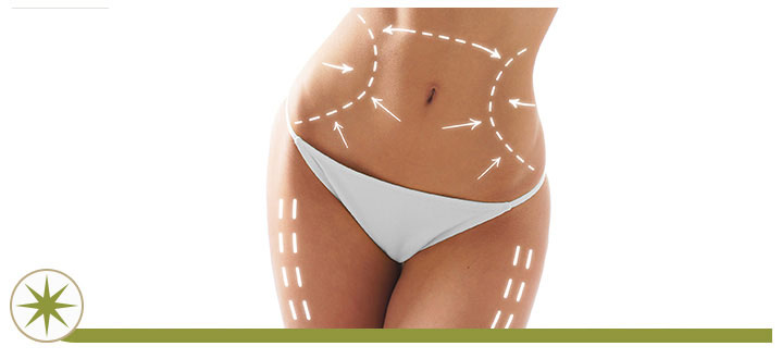 SculpSure Body Contouring in Granville, OH