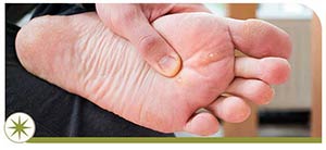 Wart Removal Specialist Near Me in Granville, OH Wart Removal Specialist Near Me in Granville, OH